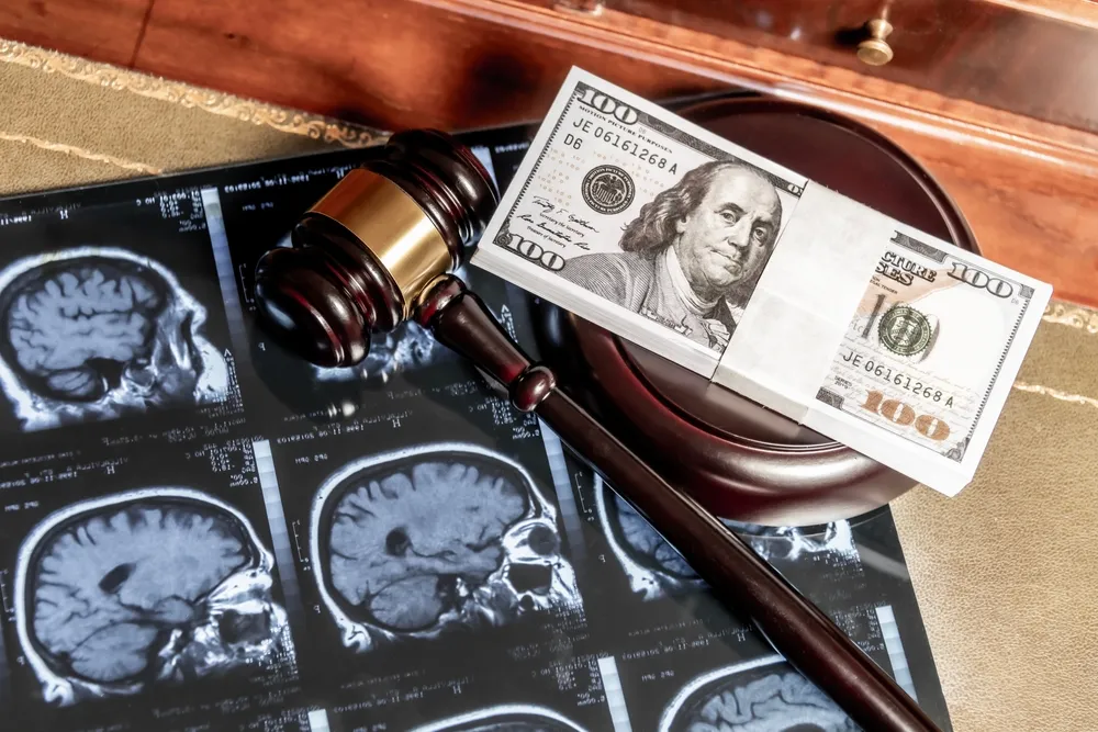 Stack of 100-dollar bills and a wooden gavel placed on brain MRI scans.